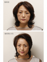 しわタルミ専用美顔ボワールリフティングお試し(約2時間・通常価格￥13,200～・お一人様一度限り)