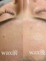 フェイシャルwax