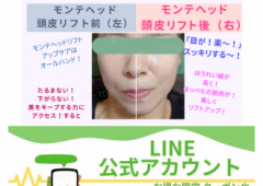 40代の美を保つキープする力へ「アクセス」する!モンテセラピー専門店の「ヘッド頭皮リフトケア」