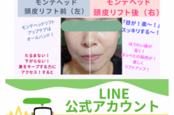 40代の美を保つキープする力へ「アクセス」する!モンテセラピー専門店の「ヘッド頭皮リフトケア」