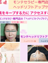 モンテセラピーヘッドリフトアップケア